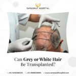 Is White or Grey Hair Eligible for Transplants?