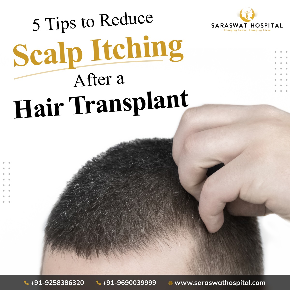 Scalp Itching After a Hair Transplant
