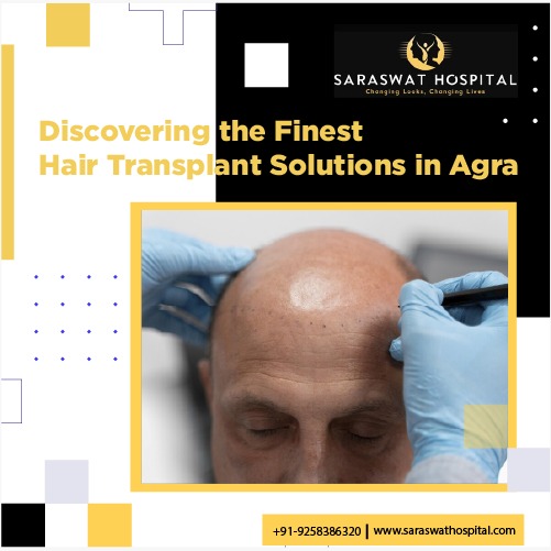 Finest Hair Transplant Solutions
