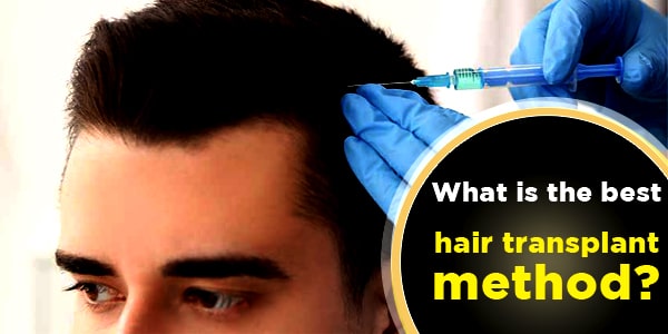 What is the best hair transplant method