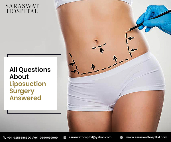 liposuction-surgery