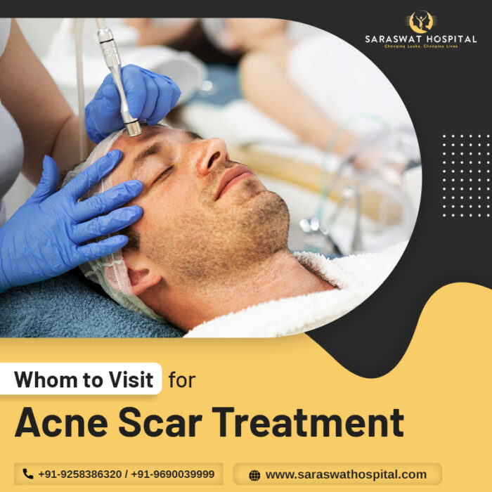 Acne scar treatment in Agra