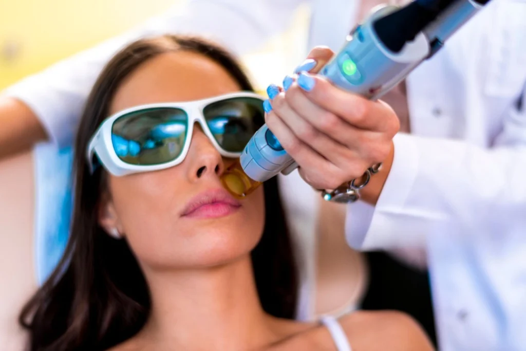 Types of Laser Hair Removal