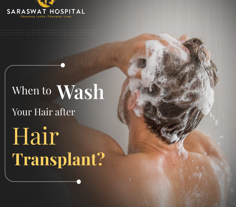 Hair Care After Hair Transplant: Essential Tips for Lasting Results