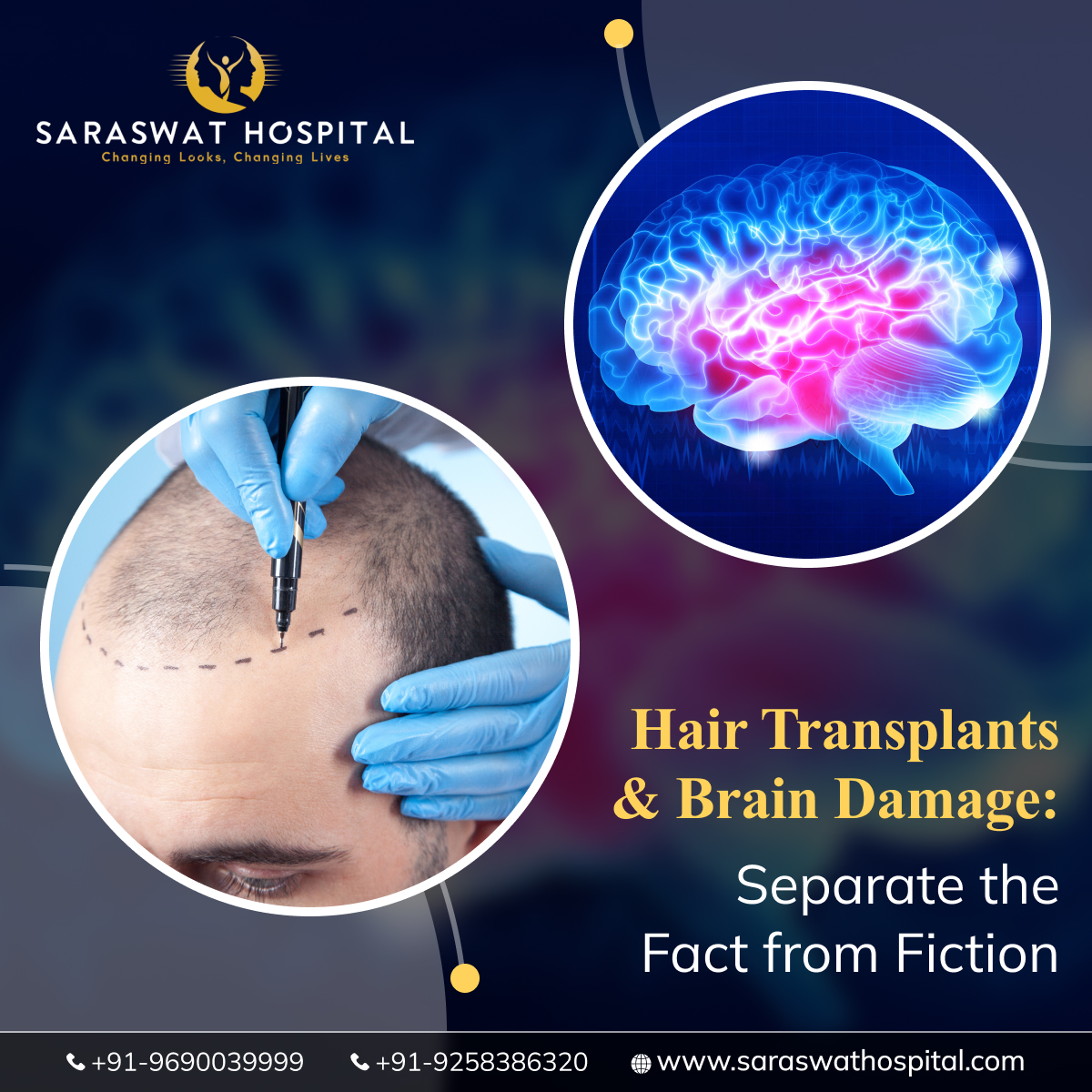 Debunk the Myths: Can Hair Transplants Cause Brain Damage?