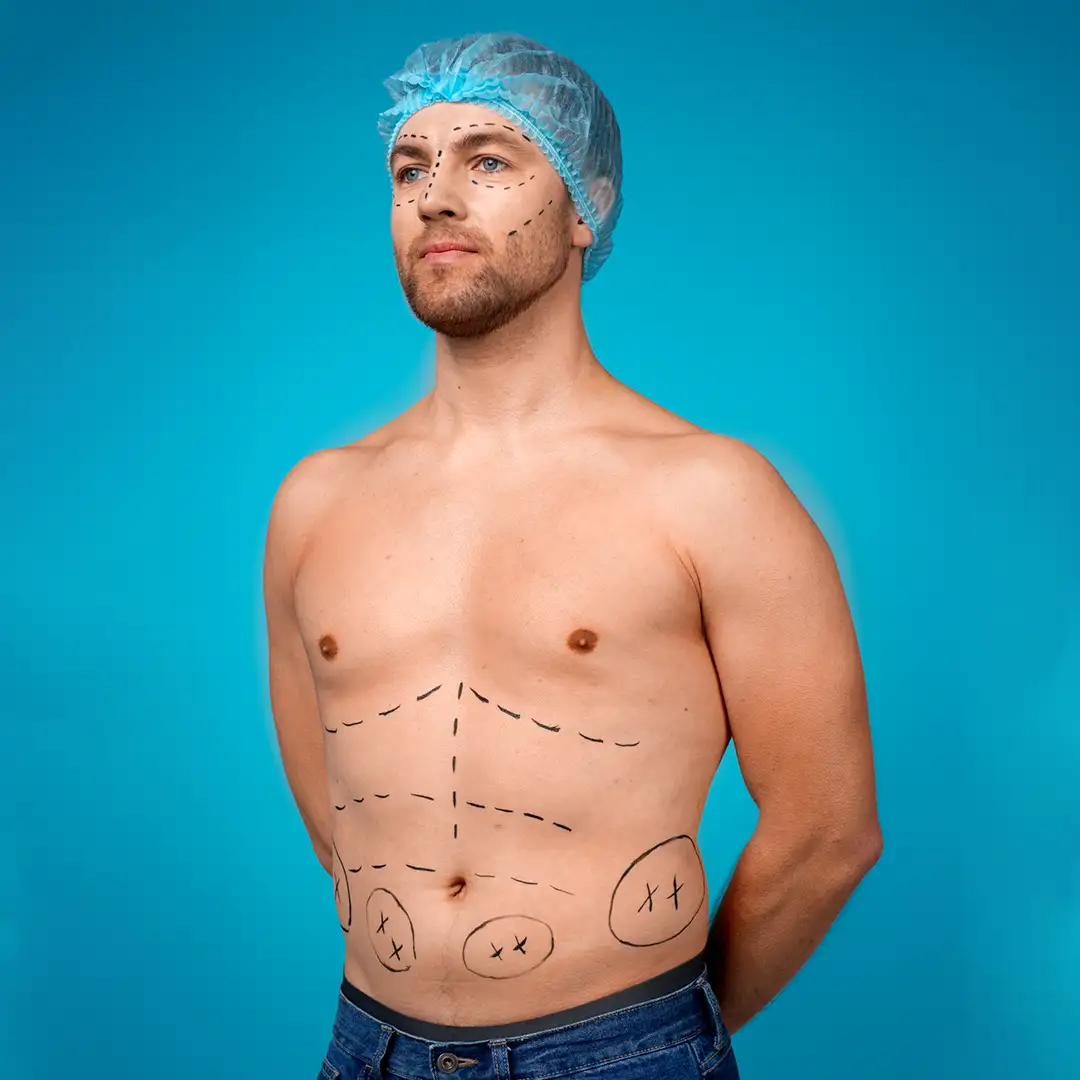 Types of Plastic Surgery