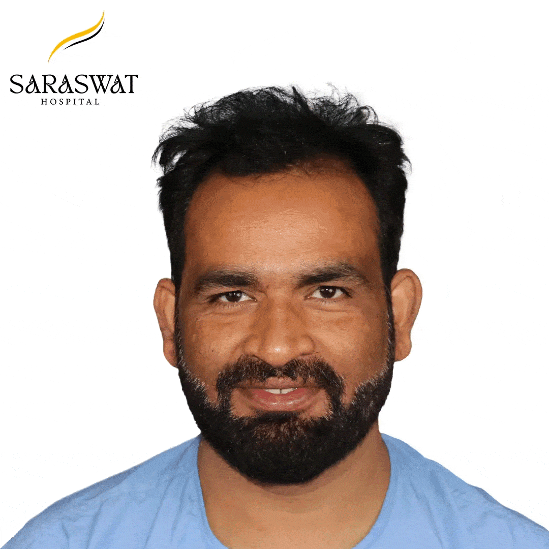FUE Hair Transplant