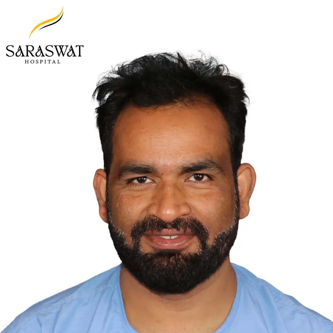 Front FUE Hair Transplant Result Before Procedure