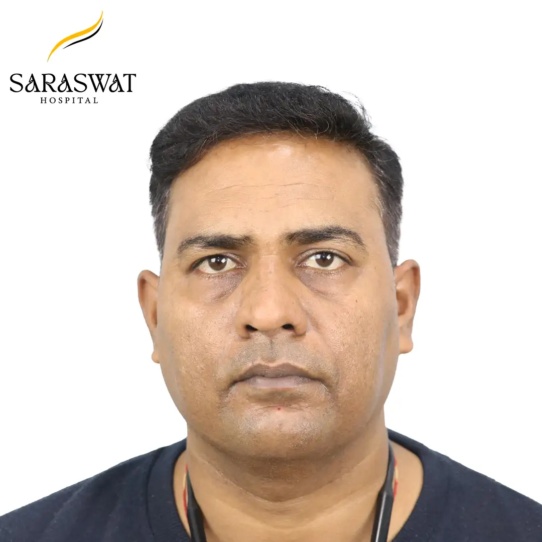 Hair Transplant Results