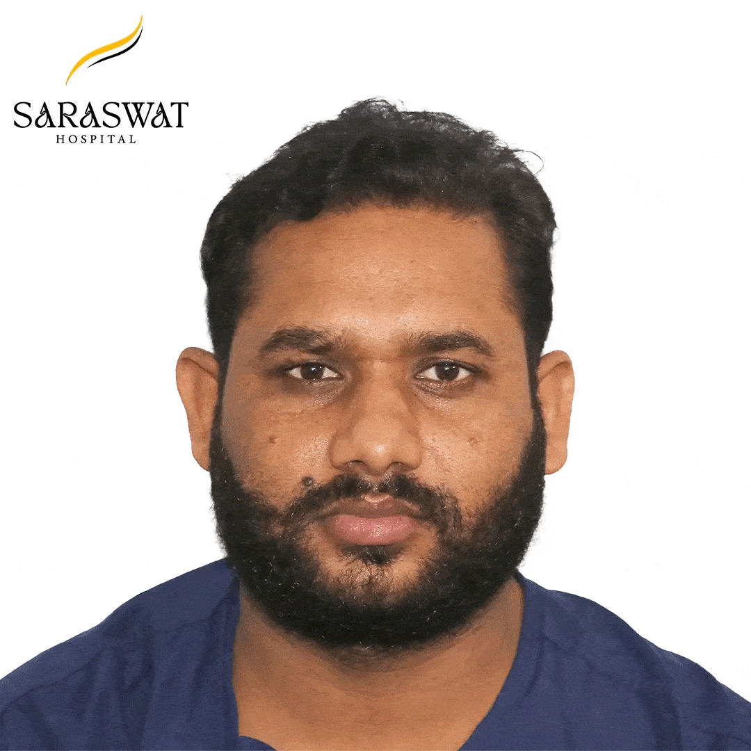 Hair Transplant Before and After Results