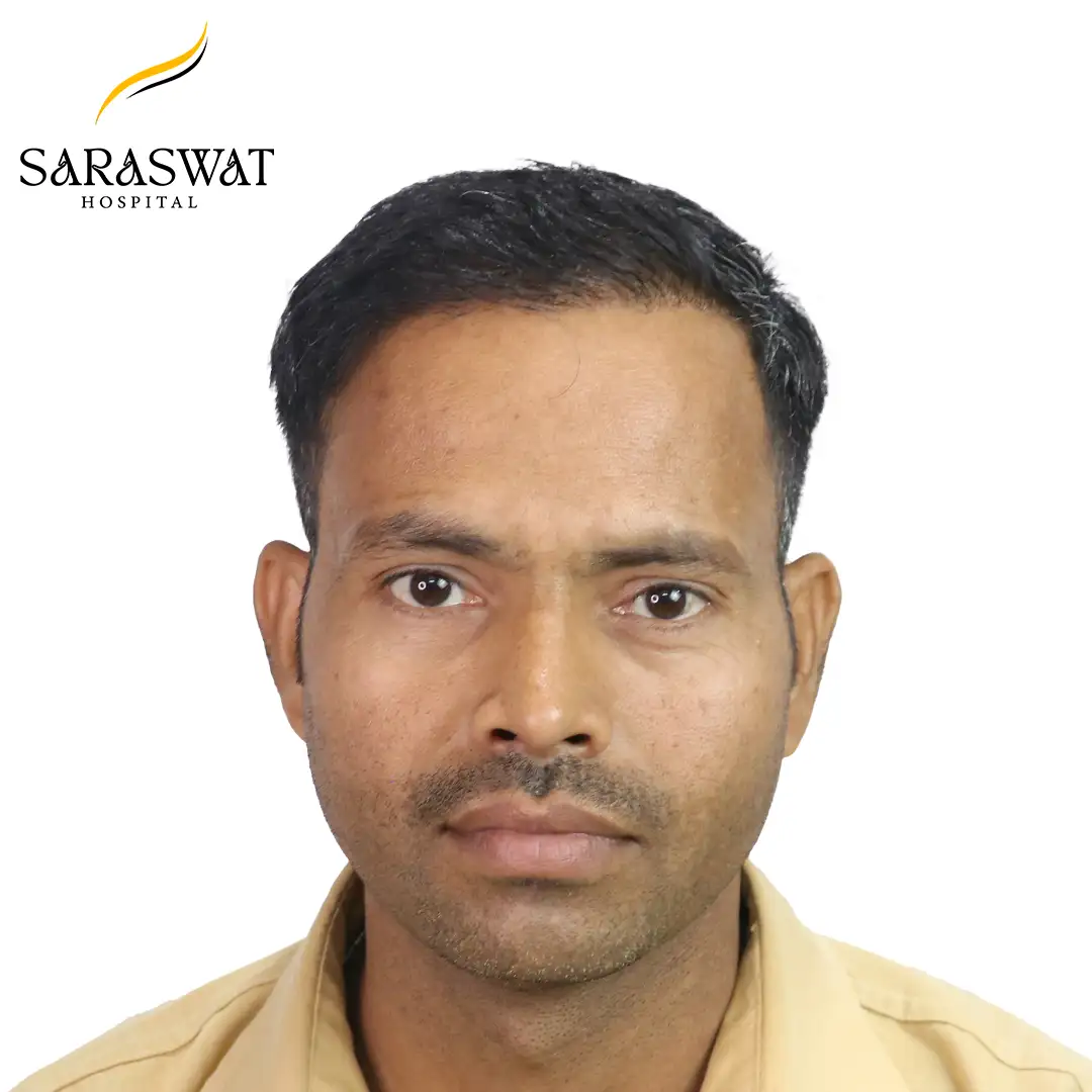 FUE Hair Transplant