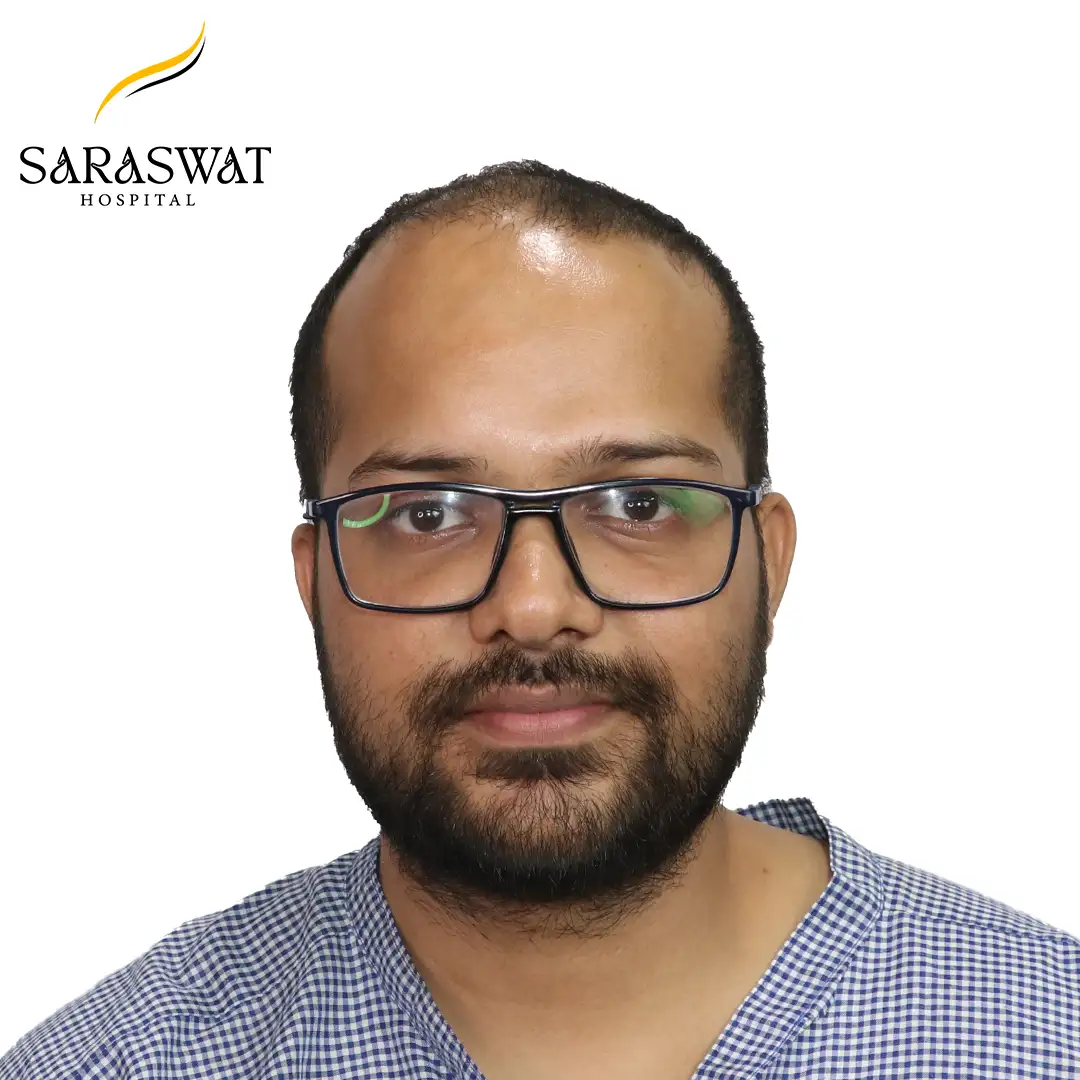 Front Hair Transplant Before and After