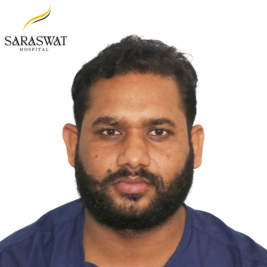 Front FUE Hair Transplant Result Before Procedure