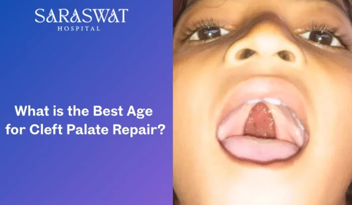 What is the Best Age for Cleft Palate Repair?