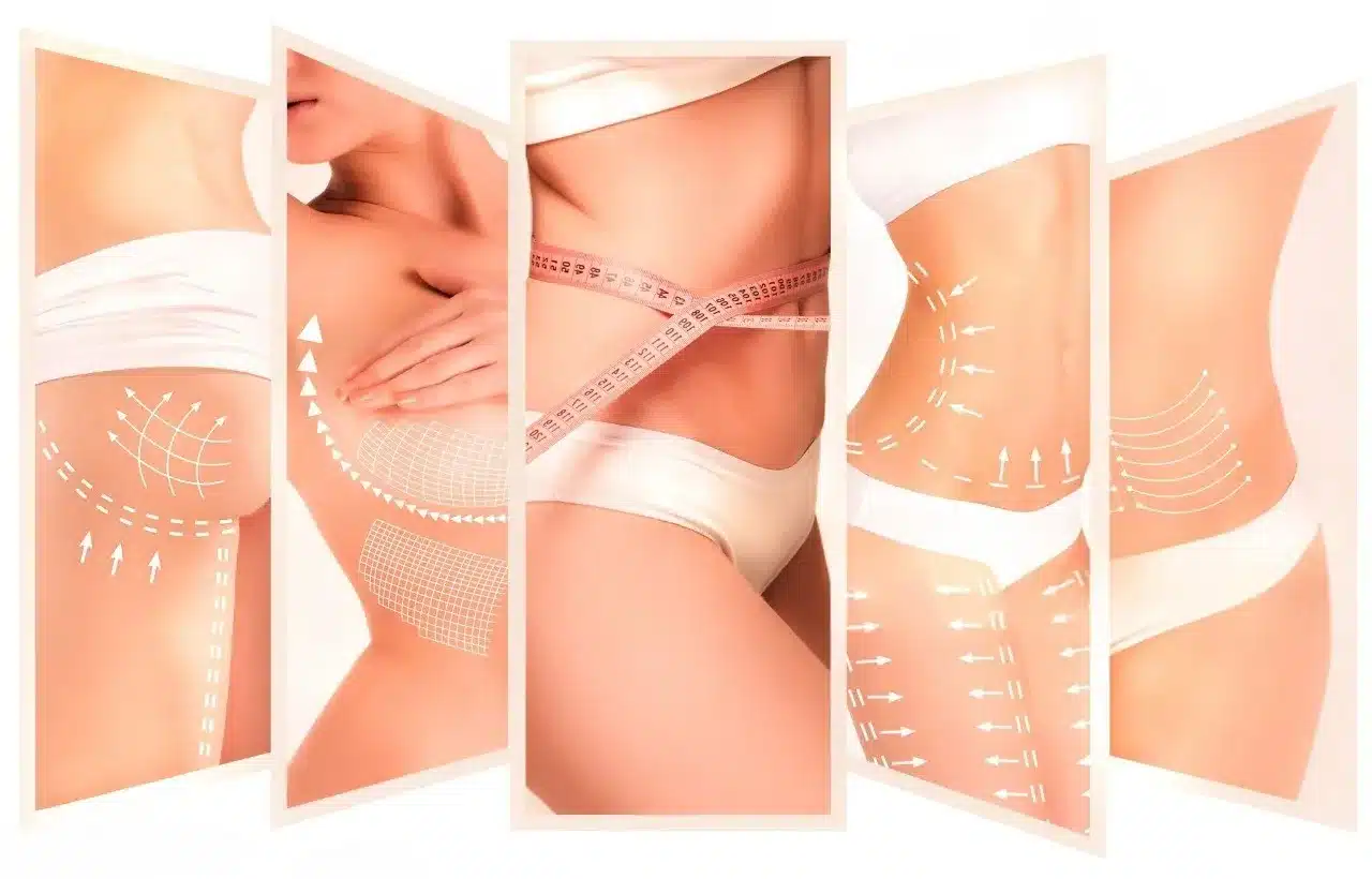 Cosmetic Surgery in India
