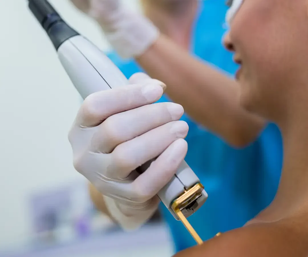 Laser Skin Resurfacing