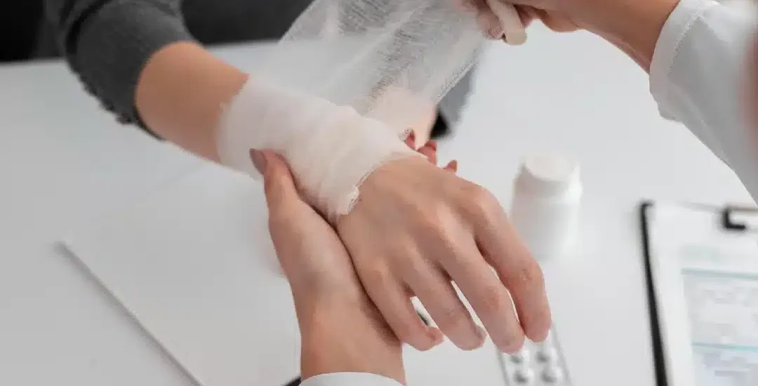 Post Burn Contracture Treatment in Agra