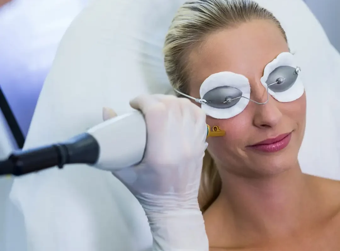 Cost of Laser Skin Resurfacing