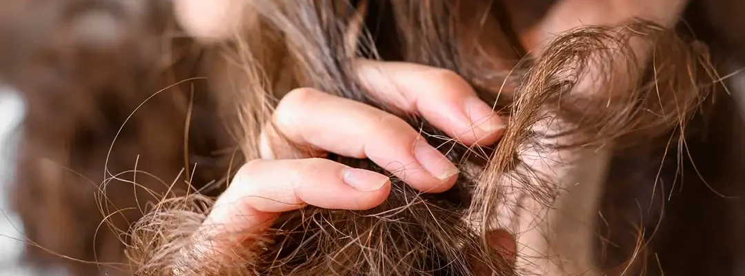Women struggling with hair loss