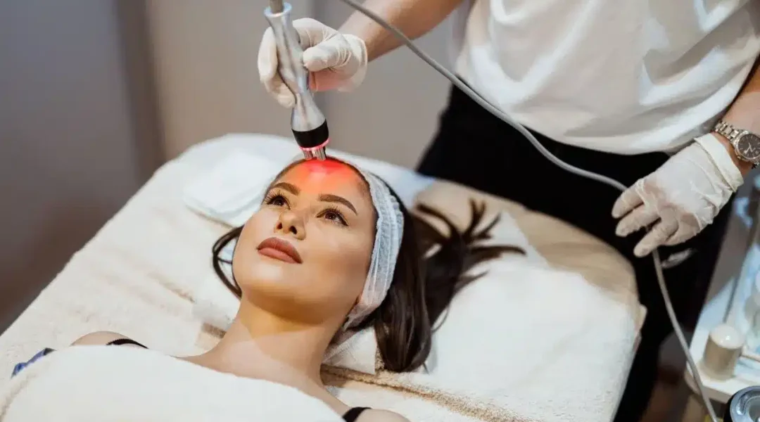 Laser Treatment for Dark Circles Under Eyes