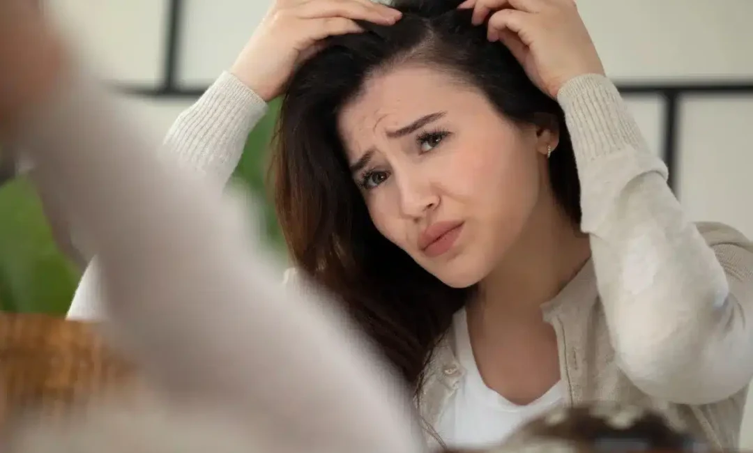 Symptoms of Hair Loss